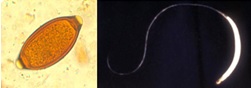 Figure 2. Trichuris (whipworm) egg and adult female worm