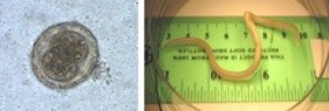 Gastrointestinal parasitic infections in immigrant and refugee children